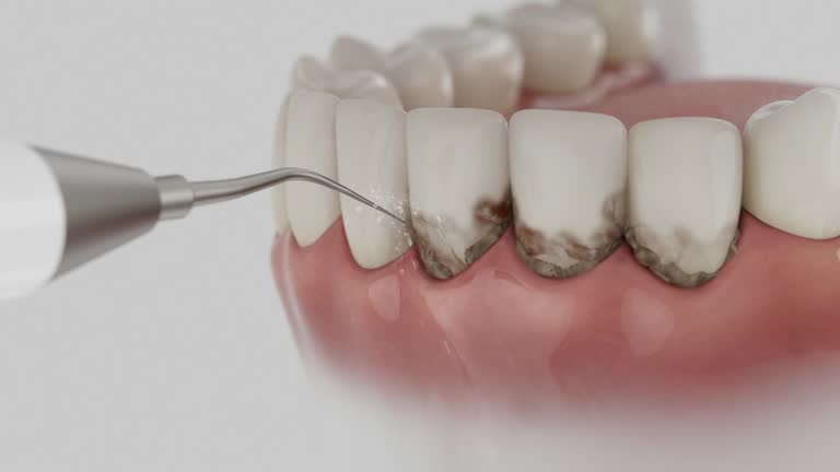 Reliable Dental contractor in Fort Pierce North, FL by Dentist Open Now